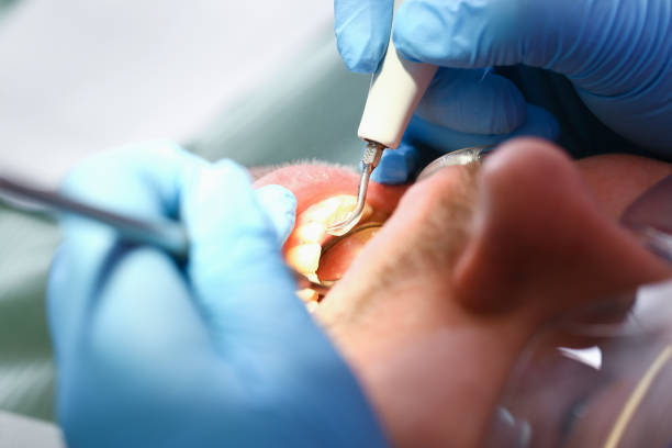 Best Same-Day Emergency Dentist in Winthrop, IA