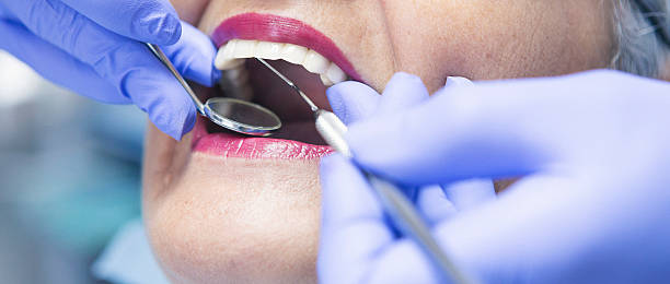 Best Emergency Tooth Extraction in Winthrop, IA