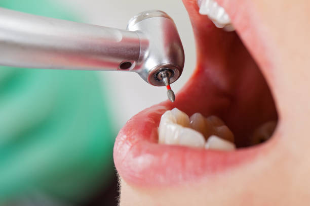 Best Pediatric Emergency Dentist in Winthrop, IA